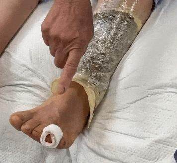 女子家门一开就被蛇咬